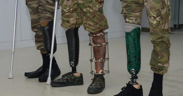 media-1632383064_1632381457_trend_qazi_protez_030221_13