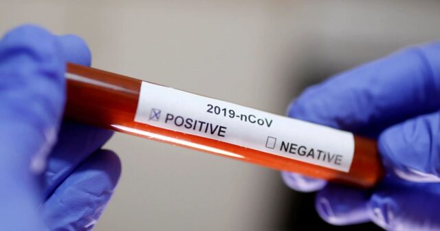 media-covid19_coronavirus_270220