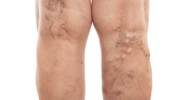 media-64311155_24858766547