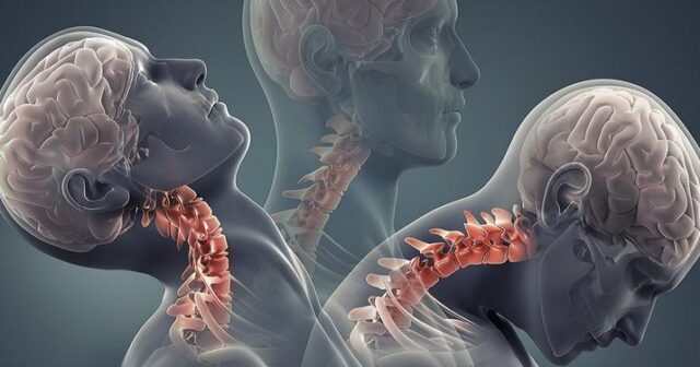 media-bas-beyin-silkelenmesi-ortuk