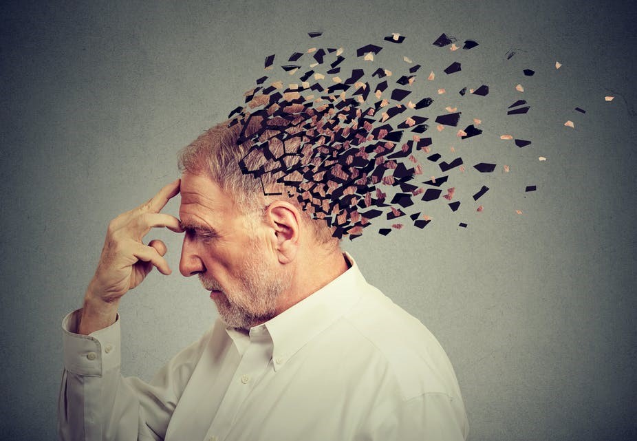 media-alzheimer